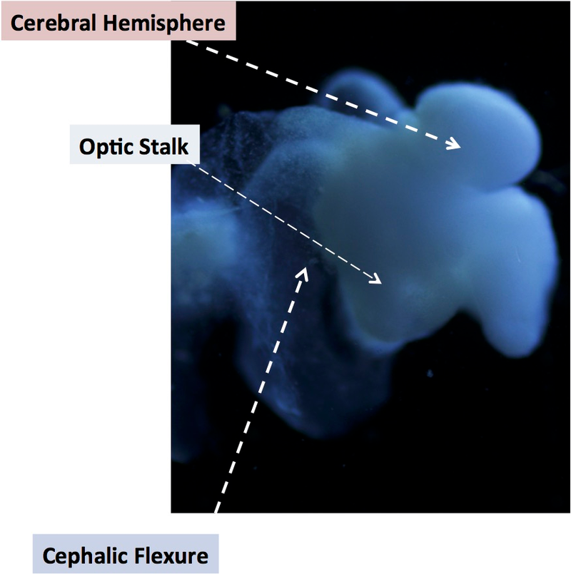Illustration for article titled Cultivan en un laboratorio el primer cerebro humano funcional